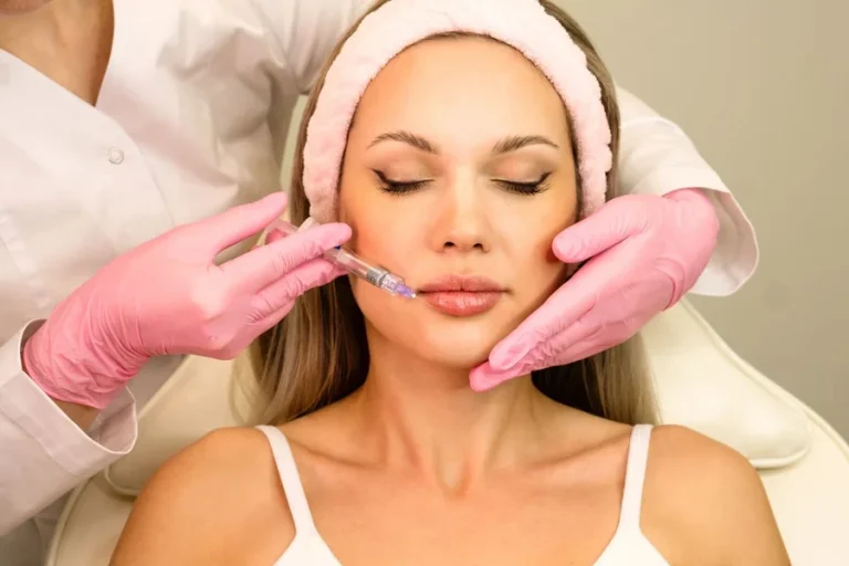 Lip Fillers A Complete Guide to Trends, Safety and Recovery