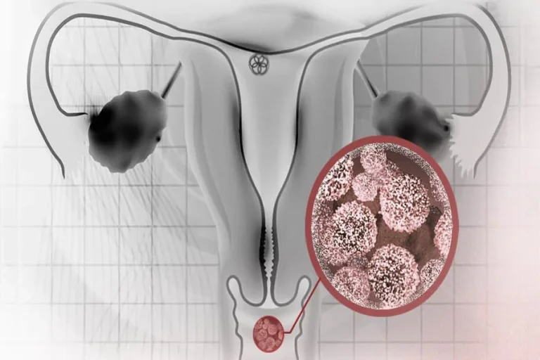 What Happens to Your Vaginal Microbiome During Pregnancy